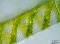 Spirogyra sp.